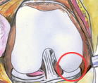 joint cartilage of the knee