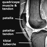 extensor mechanism of knee