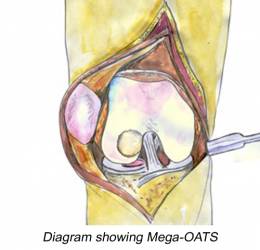 image of mega oats