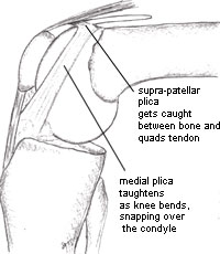Image of a bent knee to show how the plicae taughten