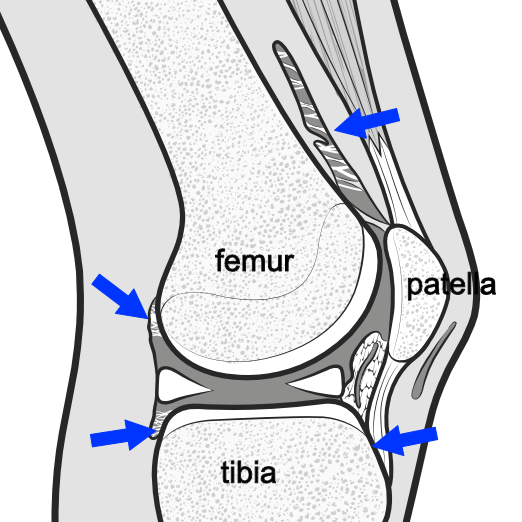 common sites for adhesions in the knee