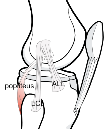 anterolateral ligament (ALL)