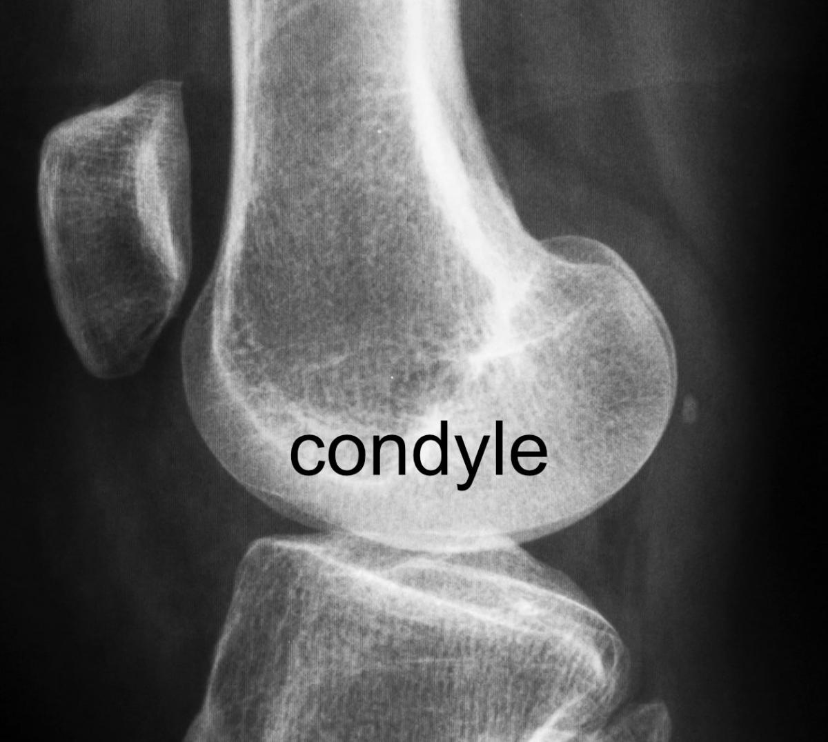 rounded condyles of femur