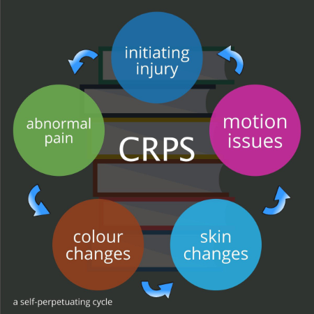 Complex regional pain syndrome cycle