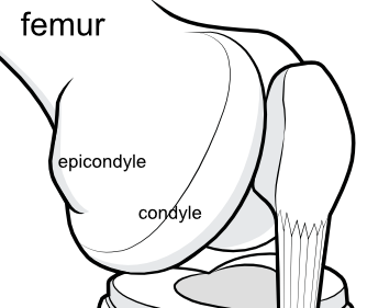 femoral epicondyle