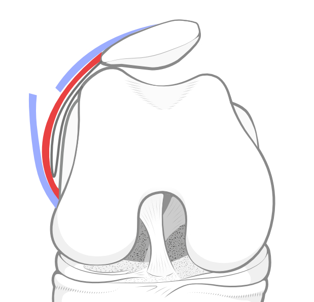 lateral retinacular lengthening