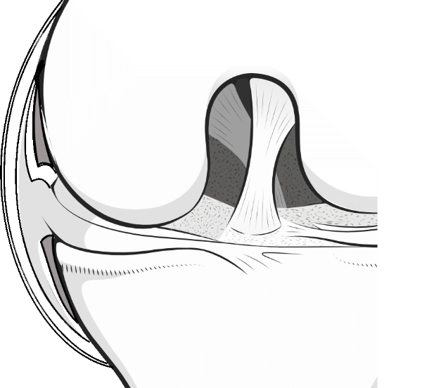 knee meniscus showing the menisco-capsular junction