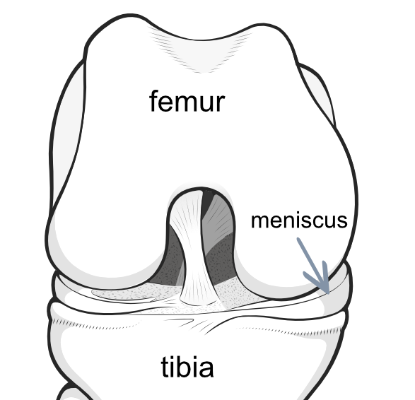 meniscus shock absorber
