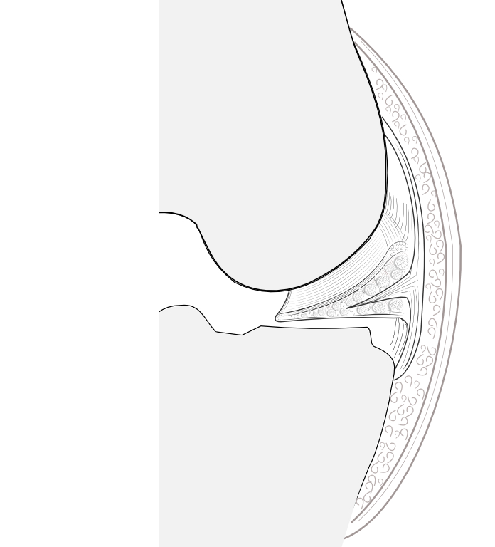 normal menisco-tibial ligament