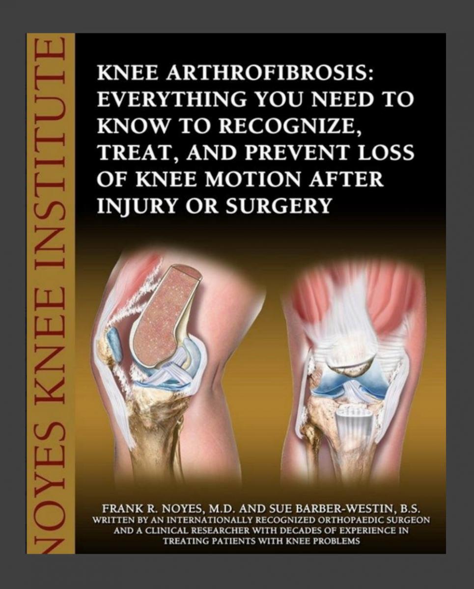 Knee arthrofibrosis
