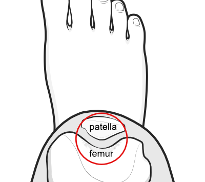 patellofemoral joint