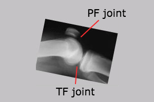 patellofemoral and tibiofemoral joints