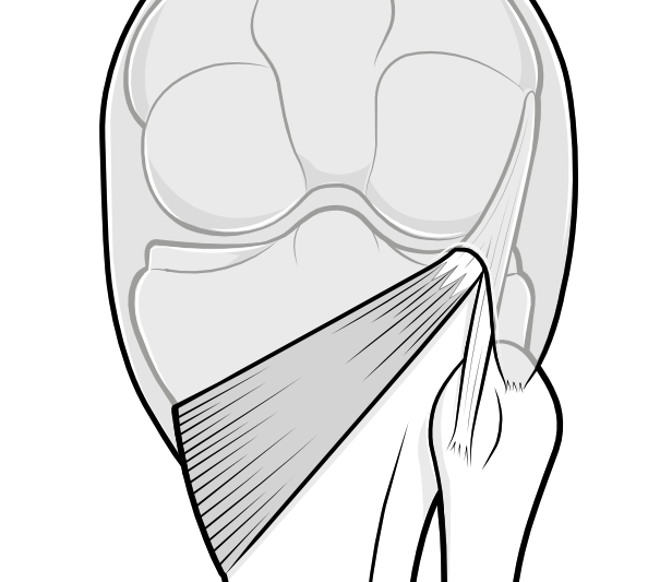 popliteus muscle and tendon passing through knee capsule at the back of the knee