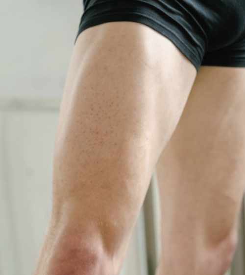 quadriceps muscle group