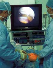 Surgeons performing an arthroscopy of the knee