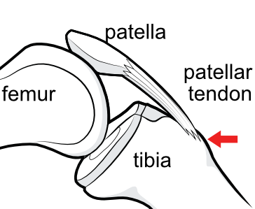 tibial tuberosity or tubercle
