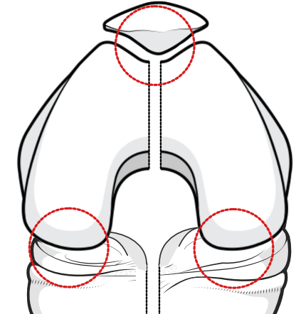 compartments of the knee