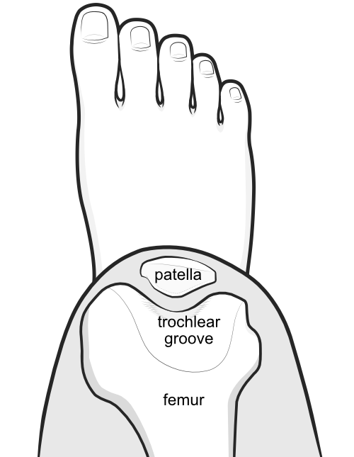 patella located within the walls of the trochlear groove