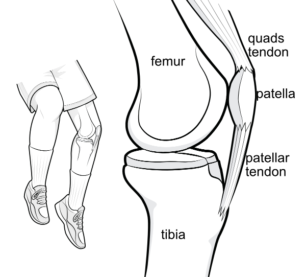 patella with patellar tendon and quads tendon